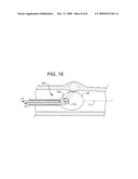 SHOCKWAVE BALLOON CATHETER SYSTEM diagram and image