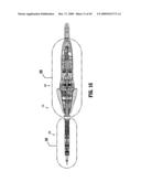 ENDOSCOPIC STITCHING DEVICES diagram and image