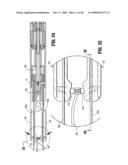 ENDOSCOPIC STITCHING DEVICES diagram and image