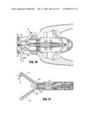 ENDOSCOPIC STITCHING DEVICES diagram and image