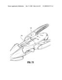 ENDOSCOPIC STITCHING DEVICES diagram and image