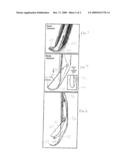 APPARATUS FOR REMOVING PLAQUE FROM AN ARTERIAL WALL AND METHOD OF USE THEREFOR diagram and image