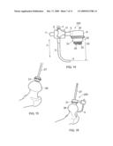 MEDICAL DEVICE diagram and image