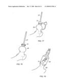 MEDICAL DEVICE diagram and image