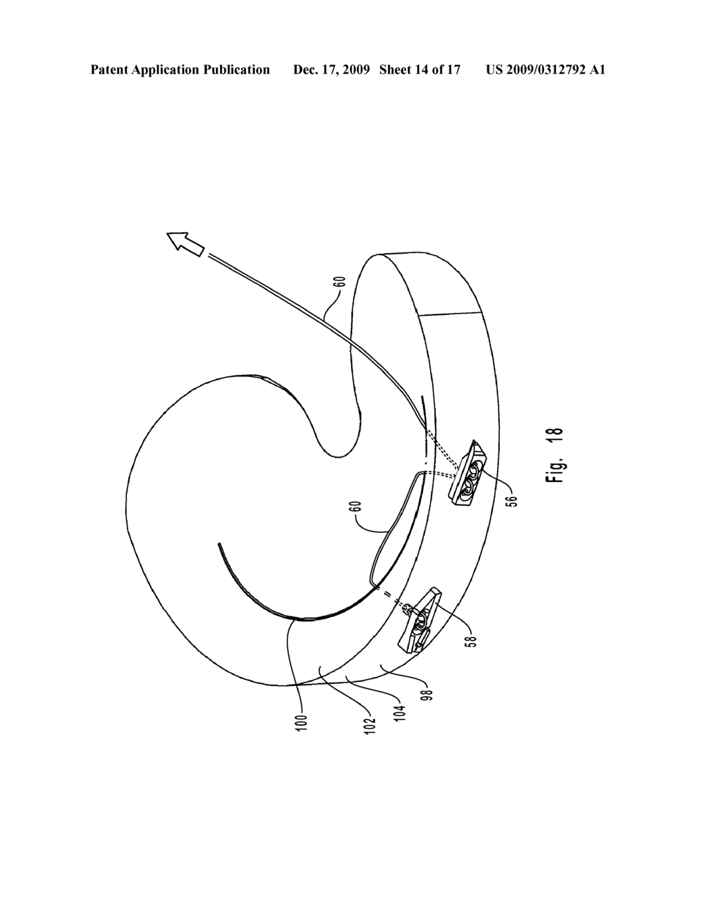 SOFT TISSUE REPAIR SYSTEM - diagram, schematic, and image 15