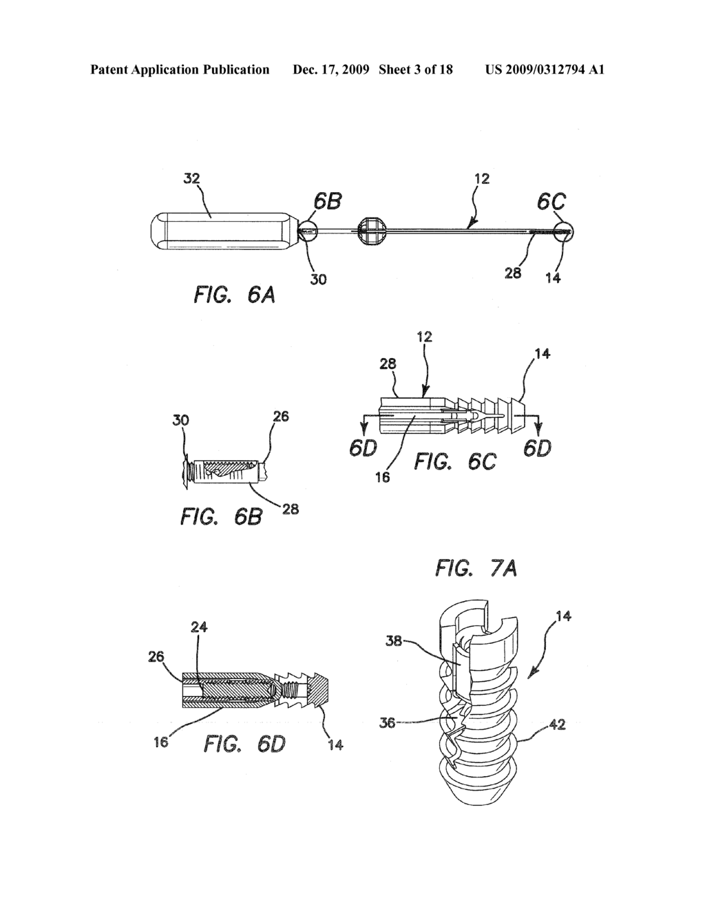 ANCHORS AND METHODS FOR SECURING SUTURE TO BONE - diagram, schematic, and image 04