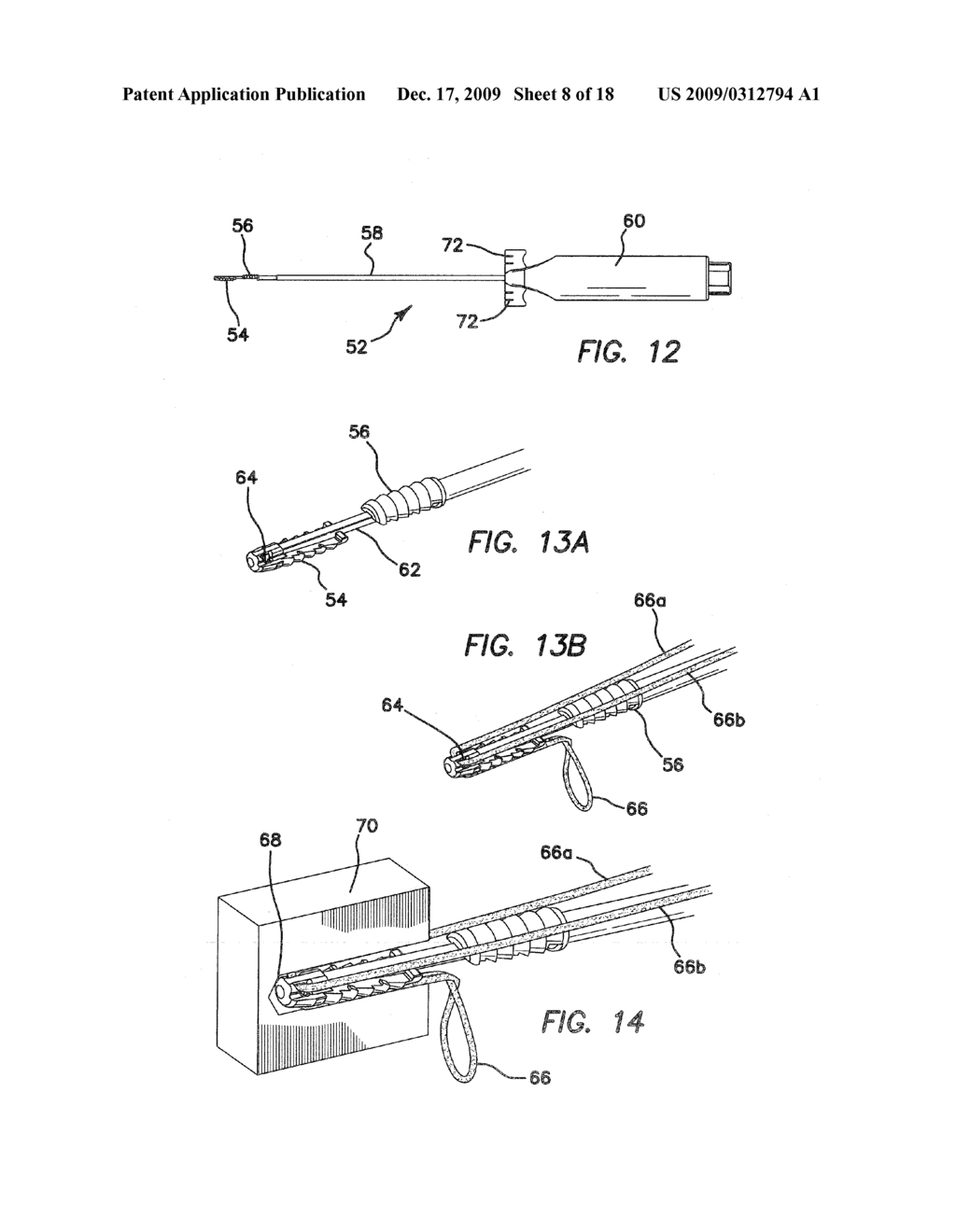 ANCHORS AND METHODS FOR SECURING SUTURE TO BONE - diagram, schematic, and image 09