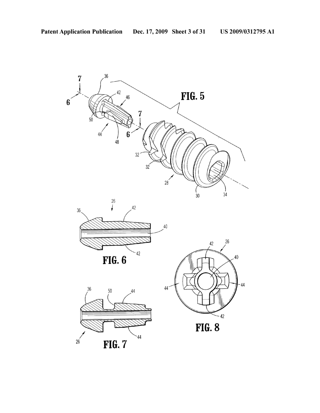 SUTURE ANCHORS - diagram, schematic, and image 04