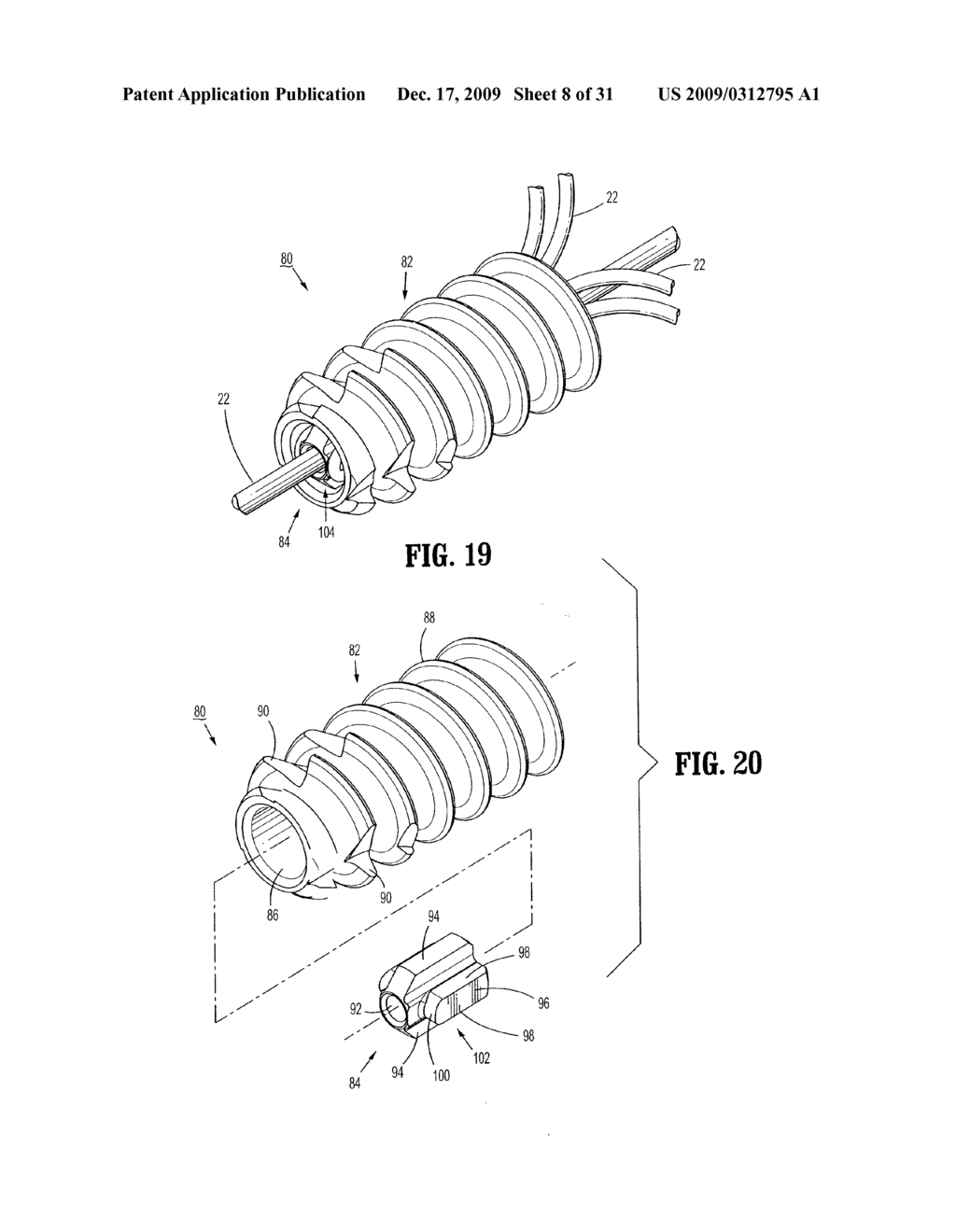 SUTURE ANCHORS - diagram, schematic, and image 09