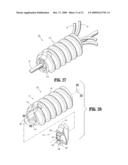 SUTURE ANCHORS diagram and image