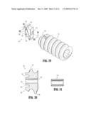 SUTURE ANCHORS diagram and image