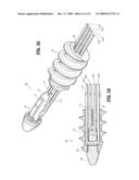 SUTURE ANCHORS diagram and image