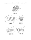 SUTURE ANCHORS diagram and image