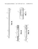 SUTURE ANCHORS diagram and image