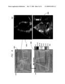 CARDIOMECHANICAL ASSESSMENT FOR CARDIAC RESYNCHRONIZATION THERAPY diagram and image