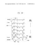 CARDIOMECHANICAL ASSESSMENT FOR CARDIAC RESYNCHRONIZATION THERAPY diagram and image