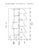 CARDIOMECHANICAL ASSESSMENT FOR CARDIAC RESYNCHRONIZATION THERAPY diagram and image