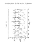 CARDIOMECHANICAL ASSESSMENT FOR CARDIAC RESYNCHRONIZATION THERAPY diagram and image