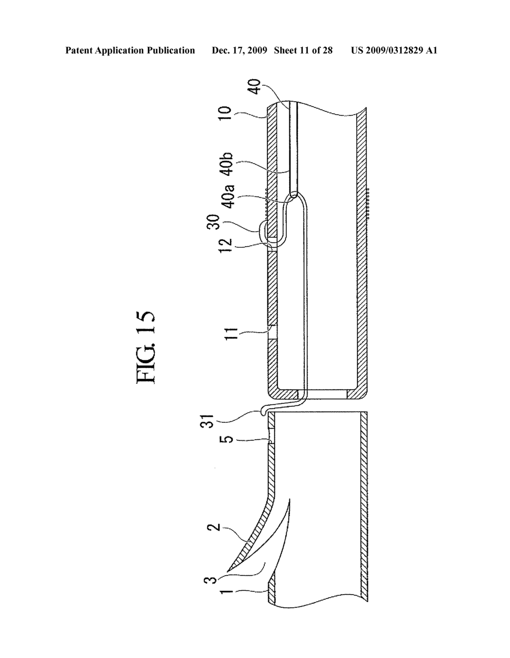 STENT DELIVERY SYSTEM AND STENT DELIVERY METHOD - diagram, schematic, and image 12