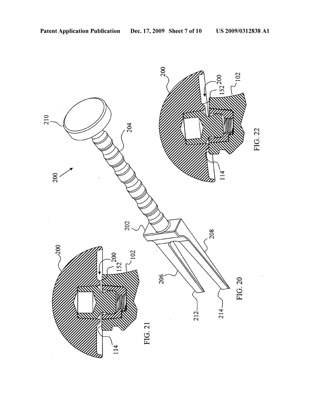 Joint Prosthesis with Positionable Head - diagram, schematic, and image 08