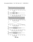 Method for Trained Discrimination and Attenuation of Echoes of a Digital Signal in a Decoder and Corresponding Device diagram and image