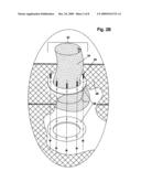 Method of dewatering solids laden liquids utilizing a reusable filter element diagram and image