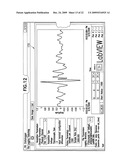 ELECTRONIC STETHOSCOPE SYSTEM diagram and image