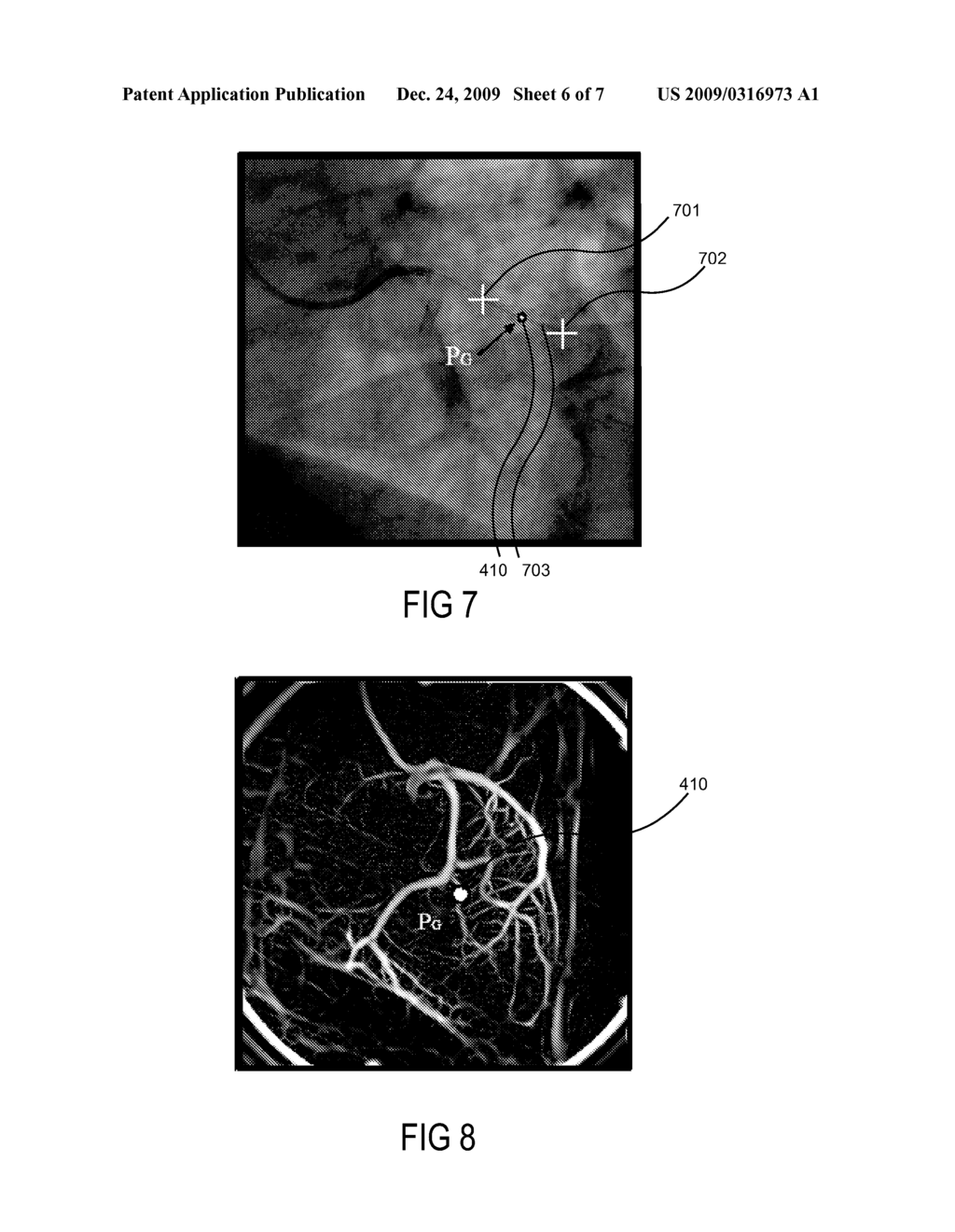 AUTOMATIC ISO-CENTERING FOR ROTATIONAL ANGIOGRAPHY - diagram, schematic, and image 07