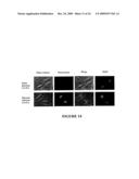 USE OF MYXOMA VIRUS FOR THE THERAPEUTIC TREATMENT OF CANCER AND CHRONIC VIRAL INFECTION diagram and image