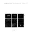 USE OF MYXOMA VIRUS FOR THE THERAPEUTIC TREATMENT OF CANCER AND CHRONIC VIRAL INFECTION diagram and image