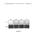 USE OF MYXOMA VIRUS FOR THE THERAPEUTIC TREATMENT OF CANCER AND CHRONIC VIRAL INFECTION diagram and image