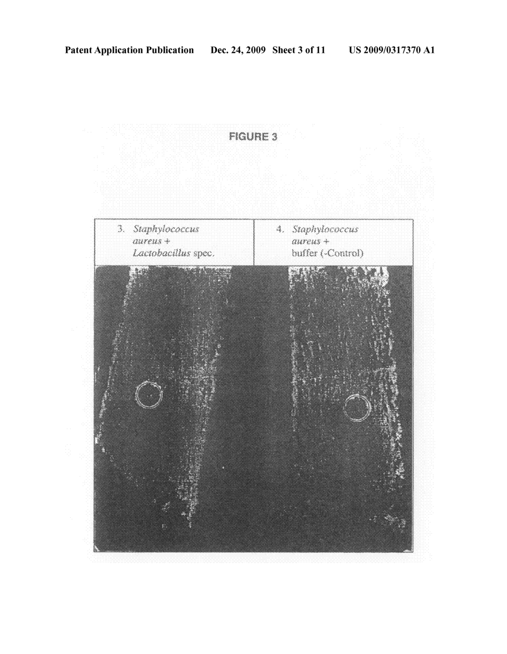 Methods And Means For Protecting The Skin Against Pathogenic Microorganisms - diagram, schematic, and image 04