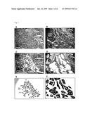 METHOD OF DIAGNOSING SMALL CELL LUNG CANCER diagram and image