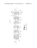 Method and System for Selective Coating of Endoluminal Prostheses diagram and image