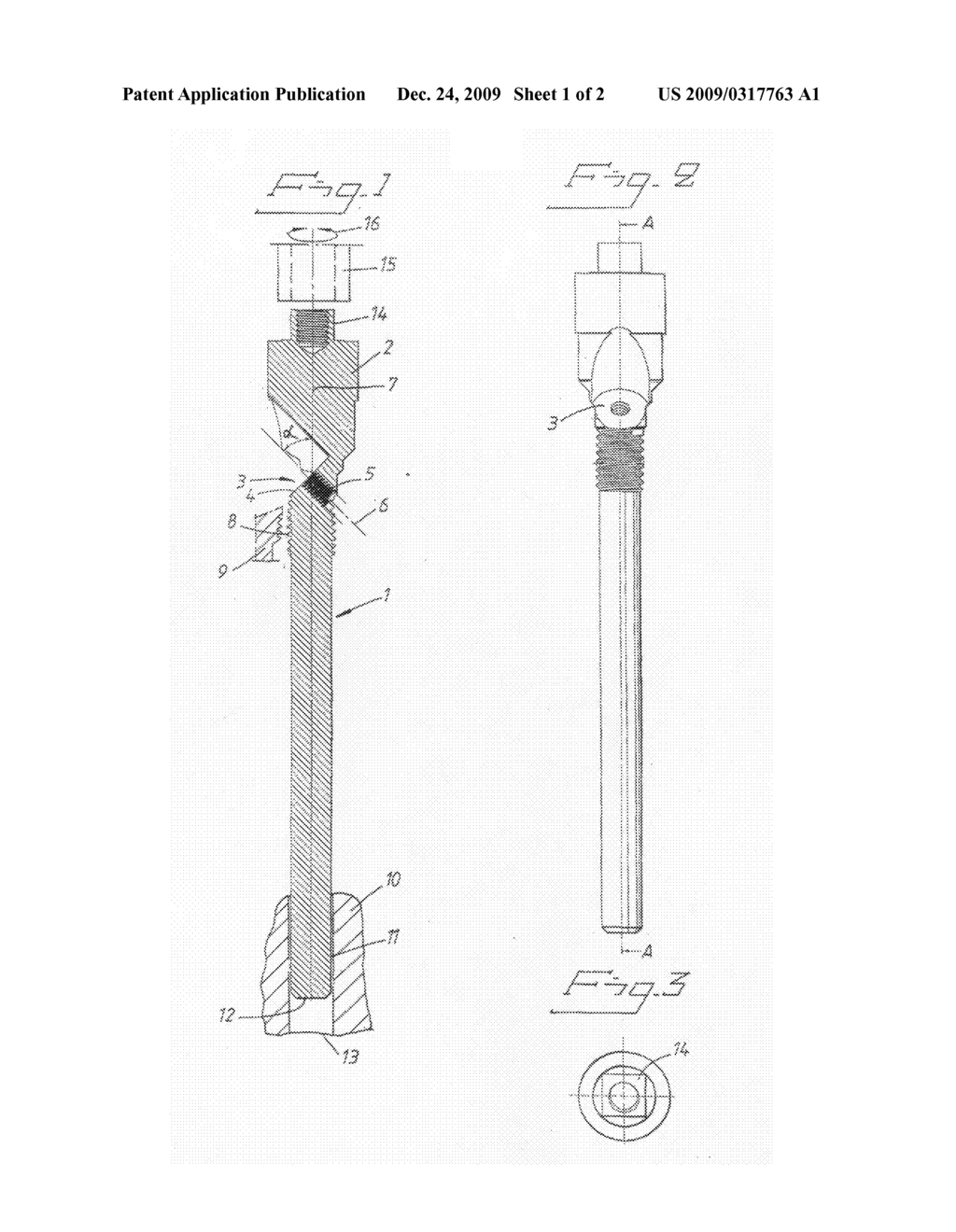 IMPLANT ARRANGEMENT - diagram, schematic, and image 02