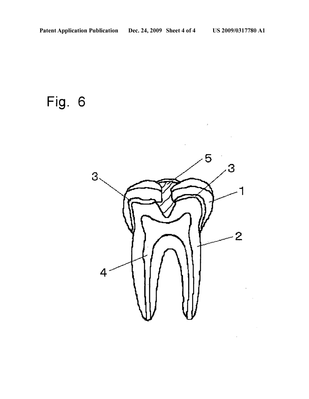 Tooth for Dental Arch Model and Method for Producing the Same - diagram, schematic, and image 05