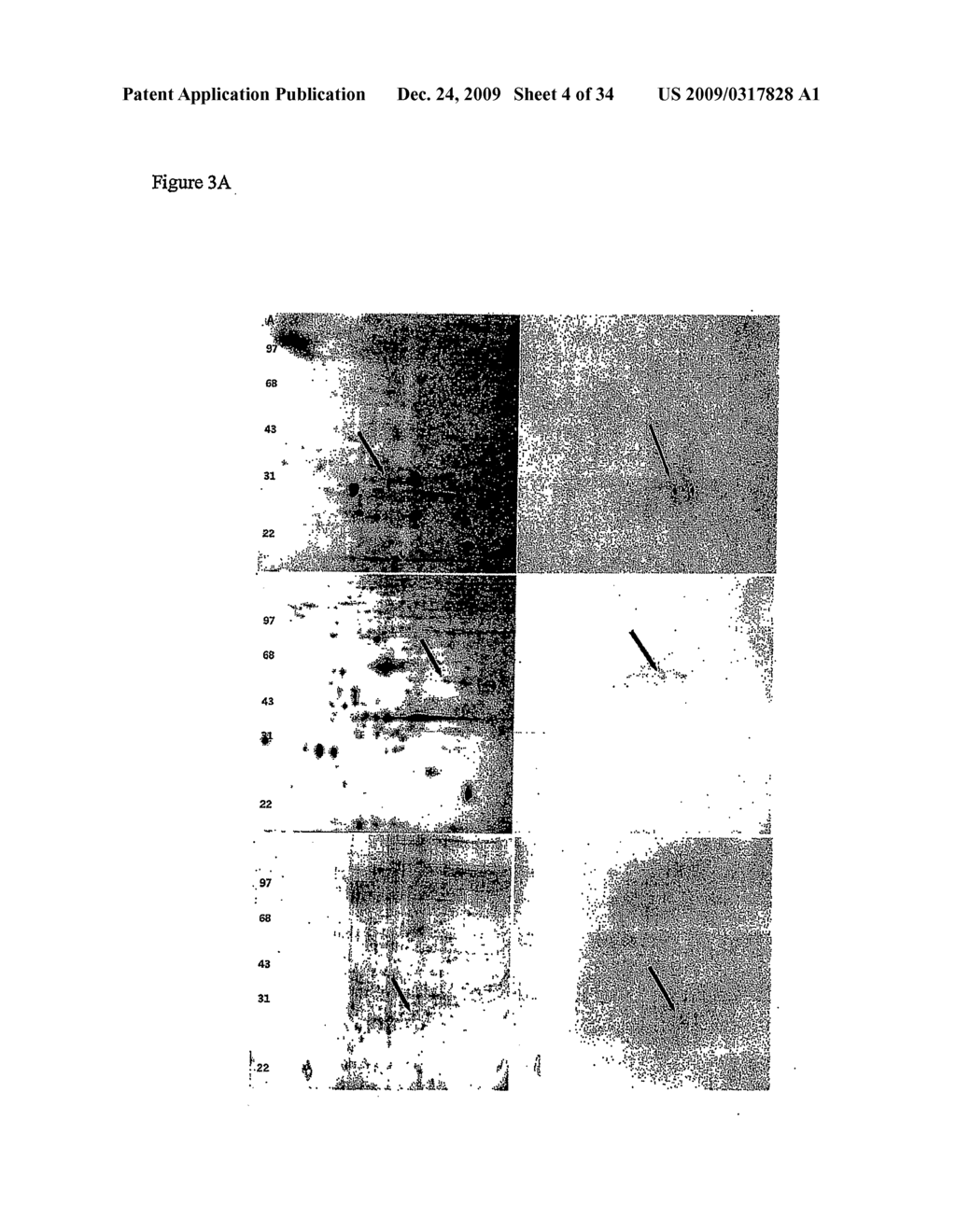 Diagnostic Kits to Detect SP22 and SP22 Antibodies - diagram, schematic, and image 05