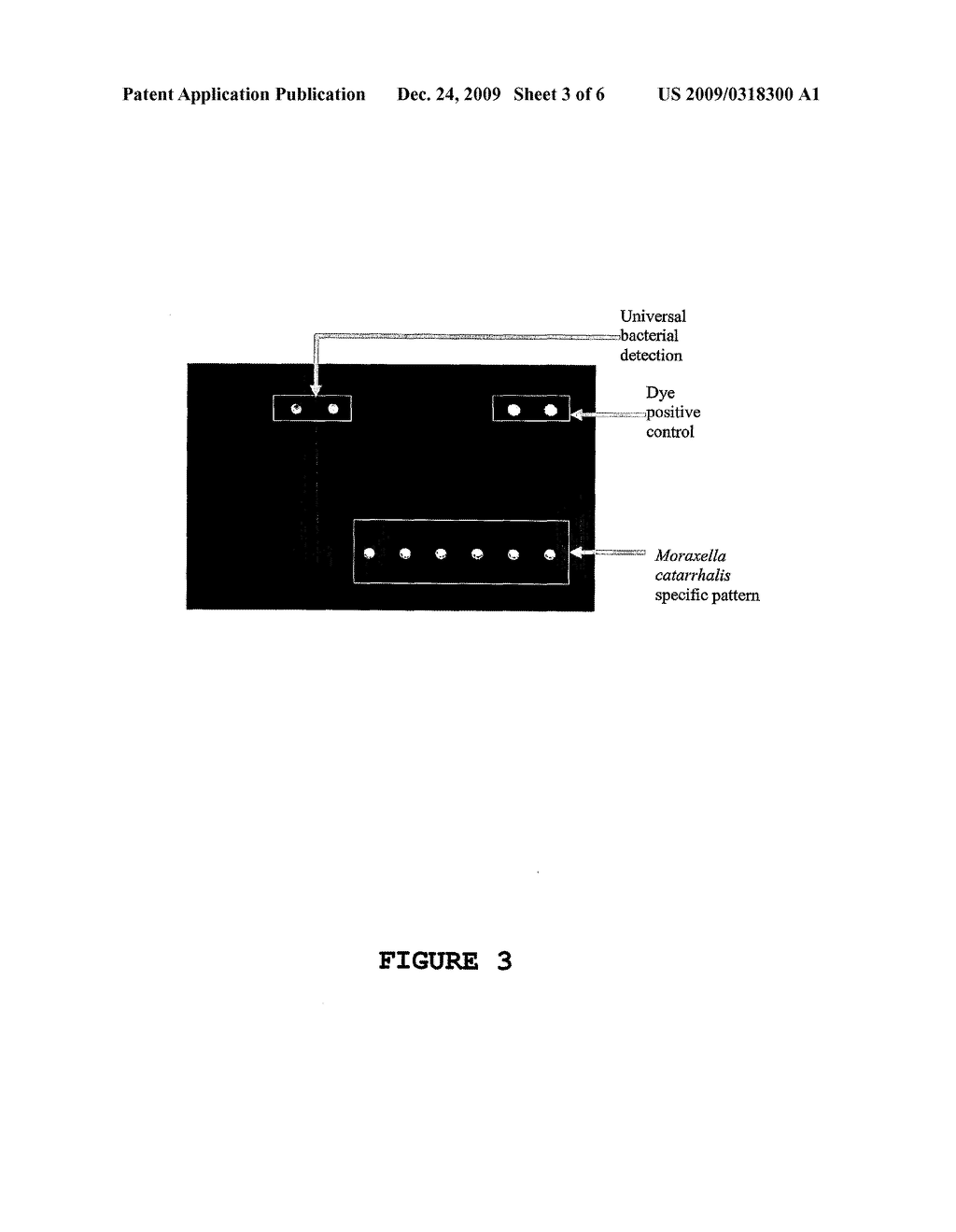 Method for the detection and/or identification of a microorganism - diagram, schematic, and image 04