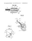 FLEXIBLE VISUALLY DIRECTED MEDICAL INTUBATION INSTRUMENT AND METHOD diagram and image