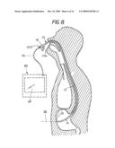 FLEXIBLE VISUALLY DIRECTED MEDICAL INTUBATION INSTRUMENT AND METHOD diagram and image