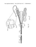 FLEXIBLE VISUALLY DIRECTED MEDICAL INTUBATION INSTRUMENT AND METHOD diagram and image