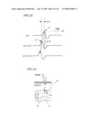 ULTRASONOGRAPH diagram and image