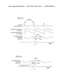 ULTRASONOGRAPH diagram and image