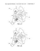 SURGICAL ORIENTATION DEVICE AND METHOD diagram and image