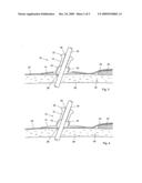 ORTHOPAEDIC PIN ISOLATOR diagram and image