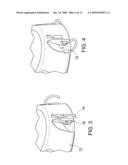 IMPLANTABLE DEVICE FASTENING SYSTEM AND METHODS OF USE diagram and image