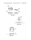 IMPLANTABLE DEVICE FASTENING SYSTEM AND METHODS OF USE diagram and image