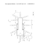 LIMB LENGTHENER diagram and image