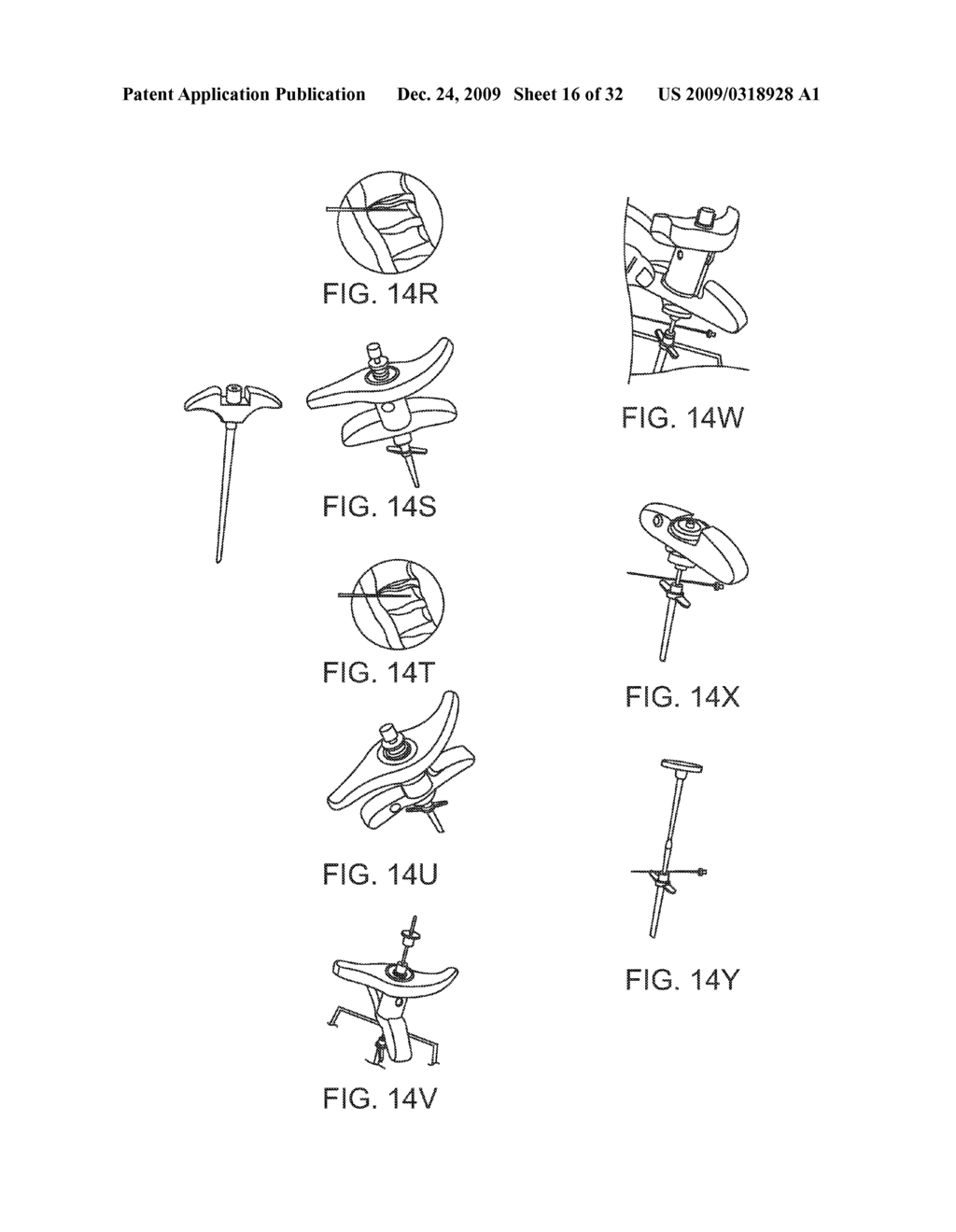 Method and Device for Inplant Deployment - diagram, schematic, and image 17