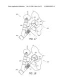 SURGICAL ORIENTATION DEVICE AND METHOD diagram and image